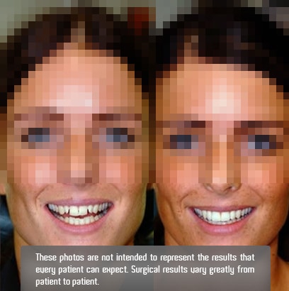 Smile_Makeover2