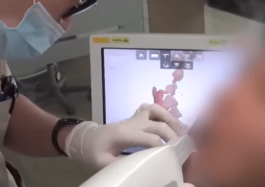 oral scan DIO