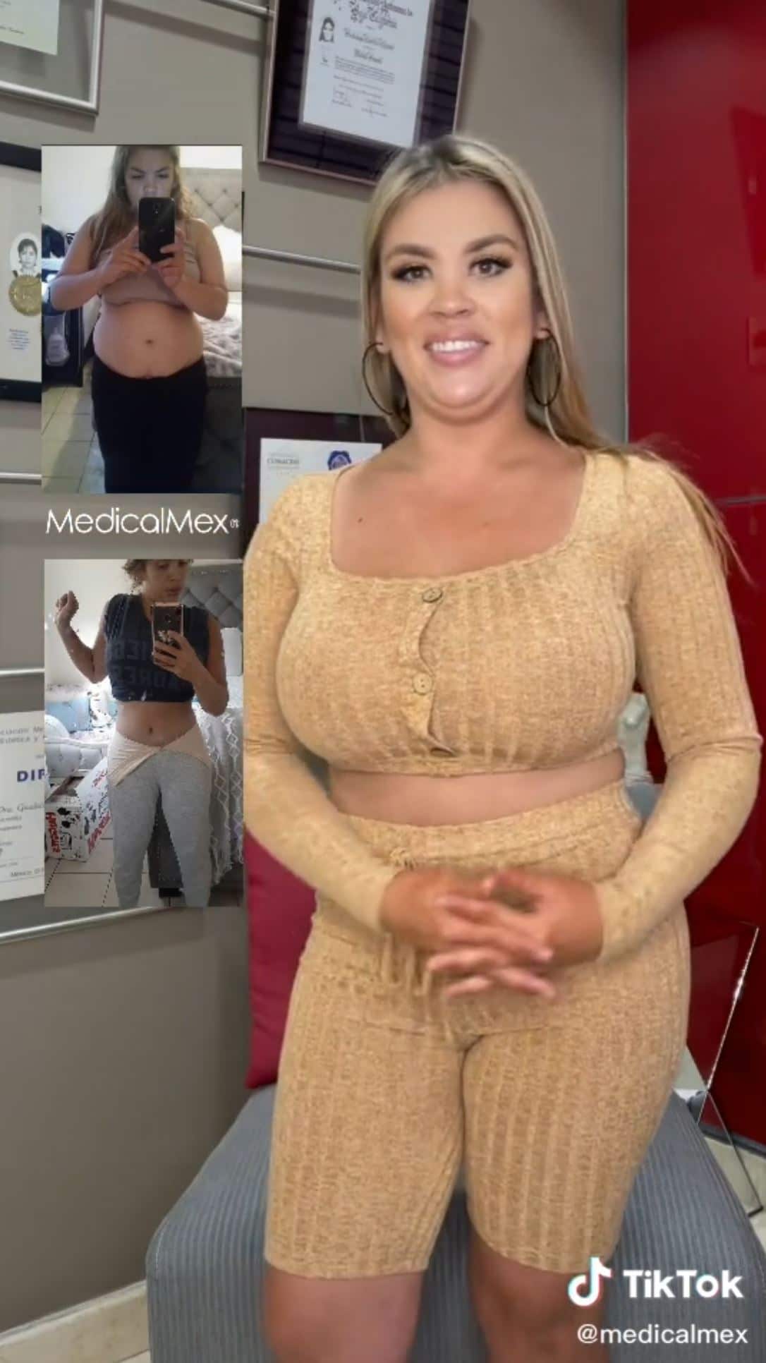 Mommy Makeover