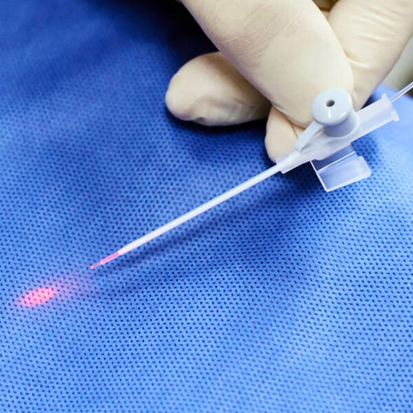 Endovenous-Laser-Ablation-EVLA-600×600